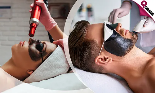 Flawless Skin with Carbon Laser Peel for Ladies & Men!